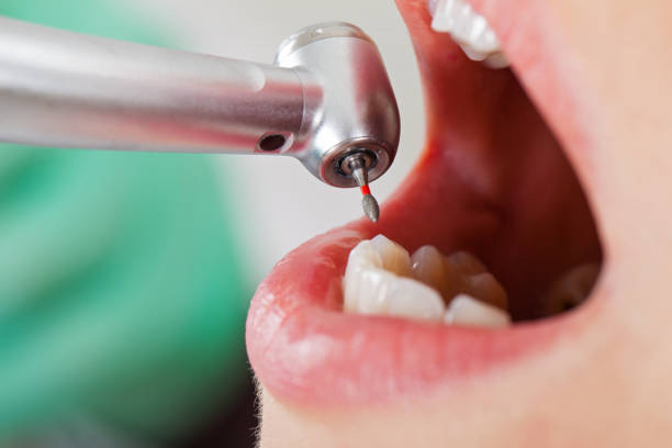 Best Broken Tooth Emergency  in Folkston, GA